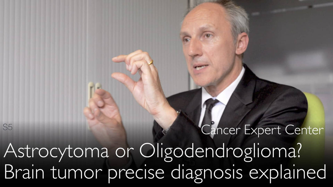 Astrocytome ou oligodendrogliome ? Comment établir un diagnostic précis des tumeurs cérébrales.
La distinction entre astrocytome et oligodendrogliome repose sur une approche