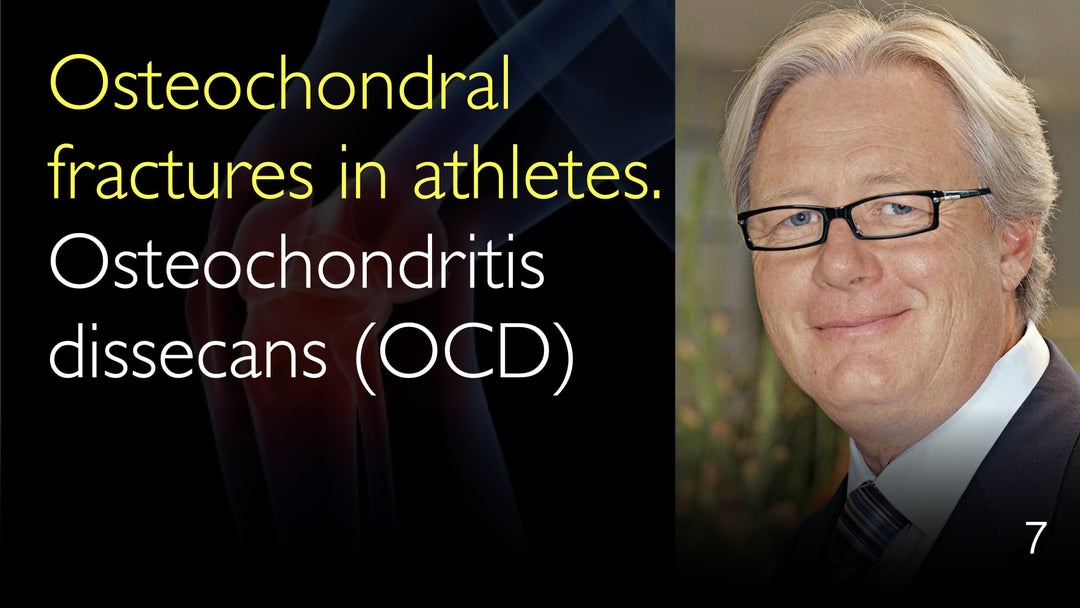 Fractures ostéochondrales chez les sportifs 
 OCD : Ostéochondrite disséquante 
 7