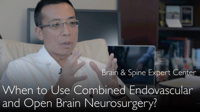 Chirurgie cérébrale combinée : endovasculaire et ouverte. Exemple 2.