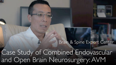 Anévrisme cérébral complexe : prise en charge endovasculaire et chirurgie ouverte. Présentation d'un cas clinique. 4