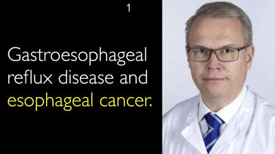 Reflux gastro-œsophagien pathologique et cancer de l'œsophage.