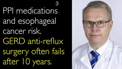 La chirurgie antireflux pour le RGO présente un taux d'échec fréquent au-delà de 10 ans. Prise d'IPP et risque de cancer de l'œsophage. 3