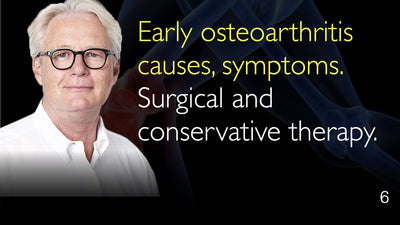 Early osteoarthritis causes, symptoms. Surgical and conservative therapy. 6