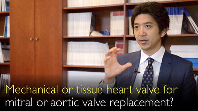Valve cardiaque mécanique ou biologique pour le remplacement valvulaire mitral ou aortique ? Valve cardiaque stentée ou non stentée ?