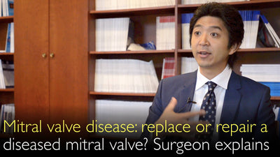 Sténose mitrale et prolapsus valvulaire mitral chez les patients âgés : remplacement ou réparation valvulaire mitrale ?