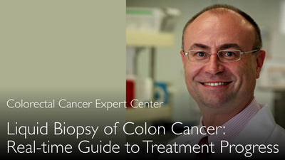Liquid biopsy of colon cancer. How to monitor cancer treatment continuously. 5